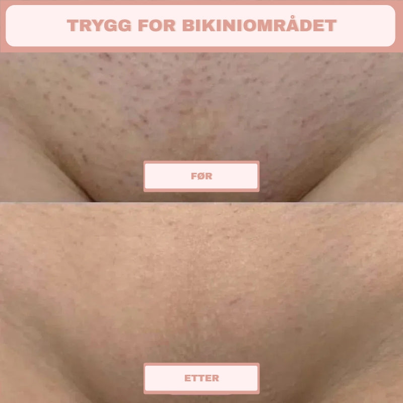 2 i 1 intim-barberhøvel